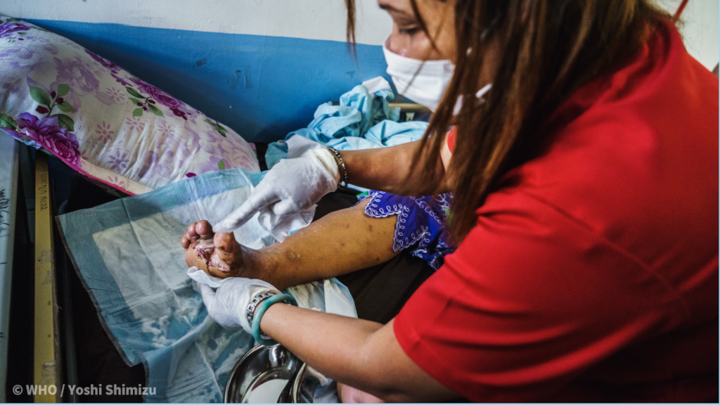 Wound management in resource-limited settings: Training for national and district-level health workers